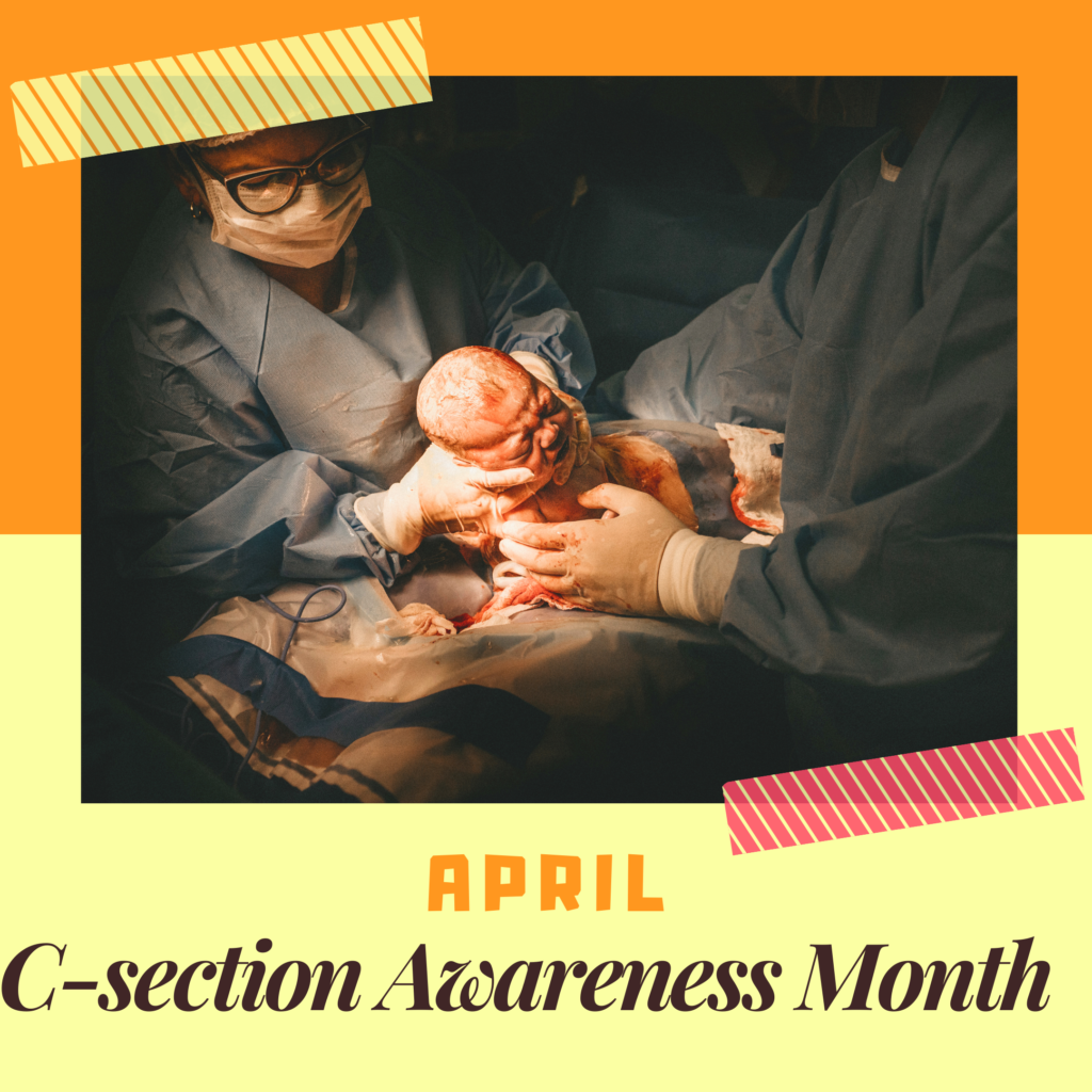 My CSection Story Oneinspiredmum